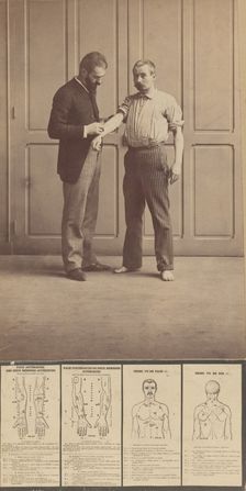 Notation of Scars, Schematic Drawings, ca. 1893., ca. 1893. Creator: Alphonse Bertillon