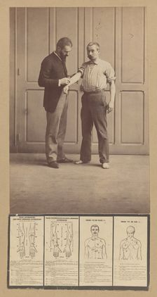 Notation of Scars, Schematic Drawings, ca. 1893. Creator: Alphonse Bertillon