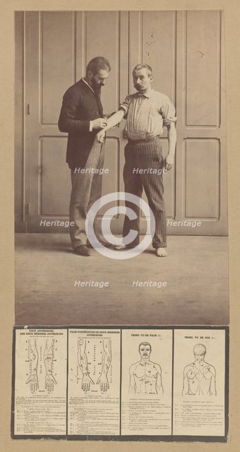 Notation of Scars, Schematic Drawings, ca. 1893. Creator: Alphonse Bertillon.