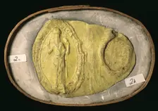 Seal of St Bartholomew's Hospital, (c12th century?). Creator: Unknown