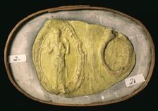 Seal of St Bartholomew's Hospital, (c12th century?). Creator: Unknown