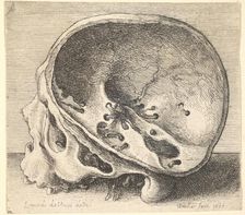 Sectioned skull in profile to left with the left side of the cranium removed, 1651. Creator: Wenceslaus Hollar