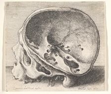 Sectioned skull in profile to left with the left side of the cranium removed, 1651. Creator: Wenceslaus Hollar