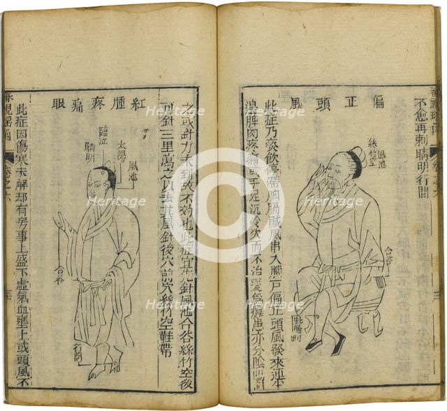 Shen Shi Yao Han (A Precious Book of Ophthalmology), 1644. Artist: Fu Renyu (active Mid of 17th cen.)
