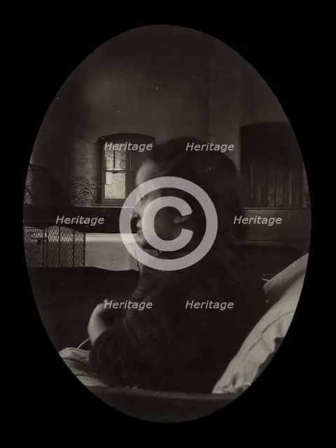 Side profile of a young woman with a misshapen head, wrapped in a tartan shawl, probably... Creator: Unknown.