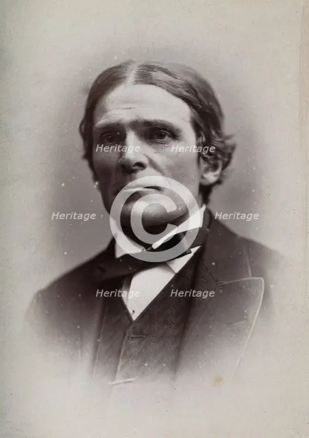 Sir John Scott Burdon-Sanderson, 1881. Creator: George Milner Gibson Jerrard.
