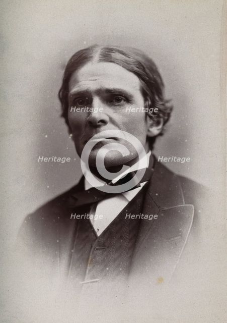Sir John Scott Burdon-Sanderson, 1881. Creator: George Milner Gibson Jerrard.