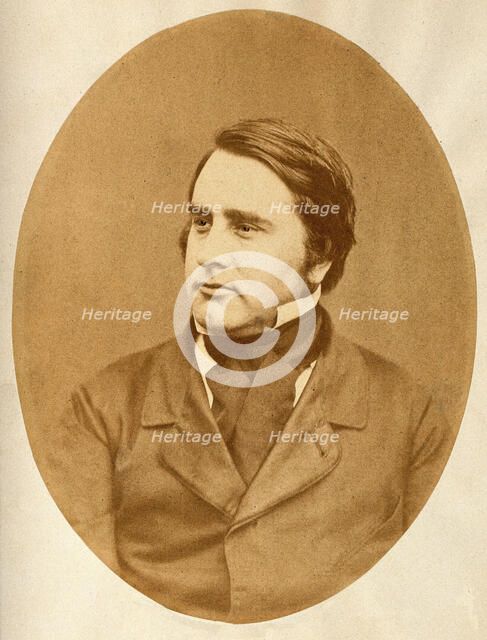 Sir William Withey Gull. Creator: Herbert Watkins.