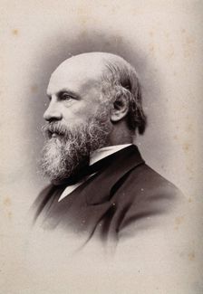 Sir William Turner, 1881. Creator: George Milner Gibson Jerrard