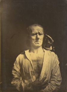 Spasm of m. corrugator supercilii under very strong light (left); A relaxed face..., 1854-1855. Creator: Duchenne de Boulogne