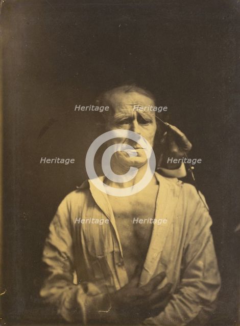 Spasm of m. corrugator supercilii under very strong light (left); A relaxed face..., 1854-1855. Creator: Duchenne de Boulogne.