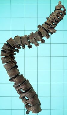 Spinal column showing the curvature of the spine. Creator: Unknown
