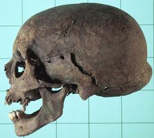 Stages in facial reconstruction of the bathrocranic skull
