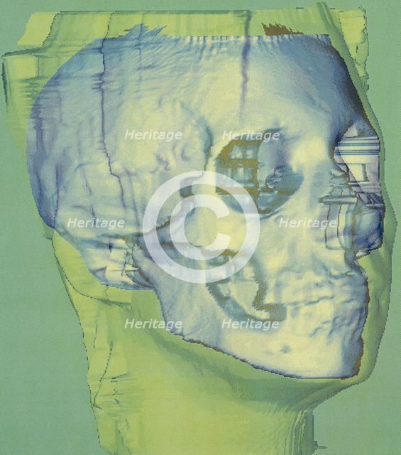 Stages in facial reconstruction of the bathrocranic skull. Creator: Unknown.