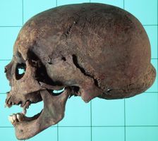 Stages in facial reconstruction of the bathrocranic skull. Creator: Unknown