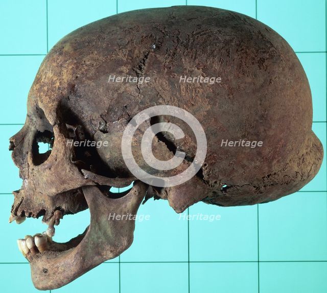 Stages in facial reconstruction of the bathrocranic skull. Creator: Unknown.