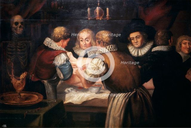 Surgeons performing an operation on a woman's breast in the seventeenth century. Creator: Unknown.