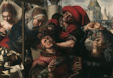 Surgery, 1550-1555. Artist: Hemessen, Jan Sanders, van (c. 1500-c. 1566)