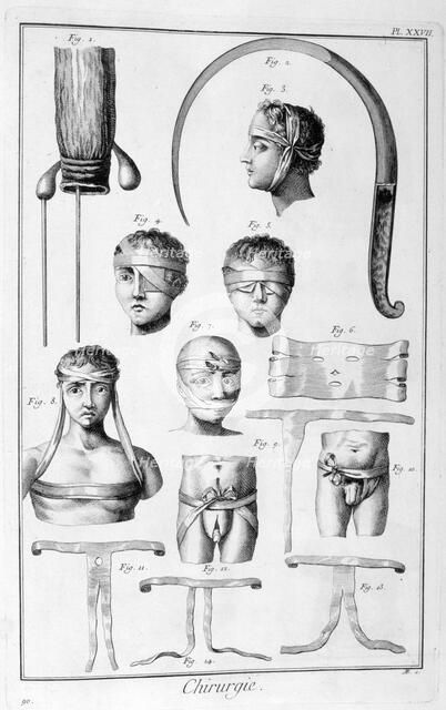 Surgery, 1751-1777. Artist: Unknown