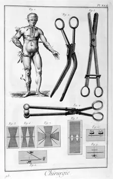 Surgery, 1751-1777