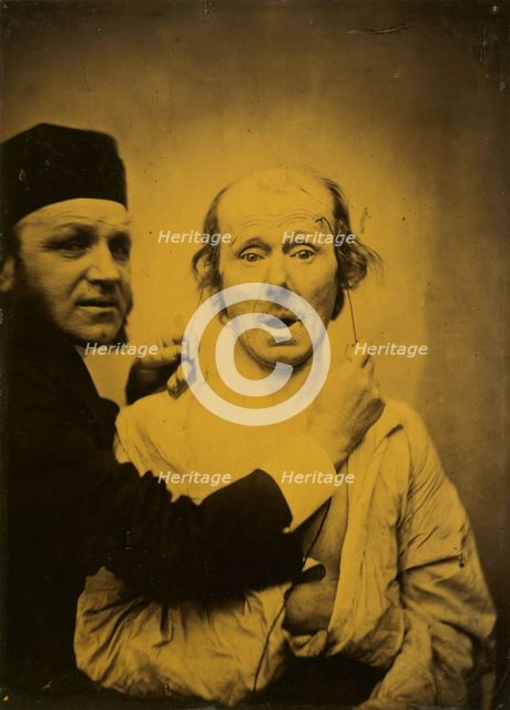 Surprise, 1854-1855, printed 1862. Creator: Duchenne de Boulogne.