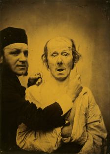 Surprise, 1854-1855, printed 1862. Creator: Duchenne de Boulogne
