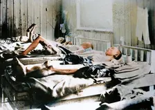 Survivors of the explosion of the Atom bomb at Hiroshima, Japan, 1945. Creator: Unknown