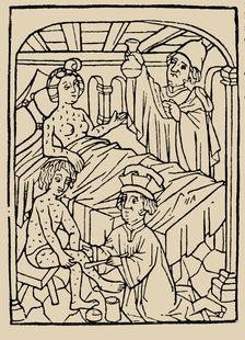 Syphilis treatment: Treatment with ointments (mercury). From: A Malafranczos morbo gallorum preserv