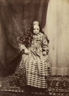 Portrait of a Female Patient, Surrey County Asylum, 1848-1858. Creator: Hugh Welch Diamond