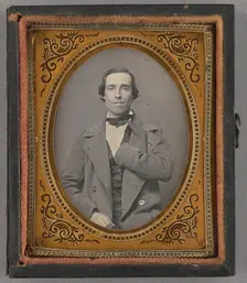 Portrait of a Seated Man with Amputated Left Arm, about 1855. Creator: Unknown