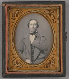 Portrait of a Seated Man with Amputated Left Arm, about 1855. Creator: Unknown