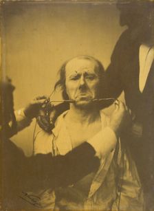 Pain and despair, 1854-1856, printed 1862. Creator: Duchenne de Boulogne
