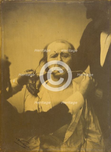 Pain and despair, 1854-1856, printed 1862. Creator: Duchenne de Boulogne.
