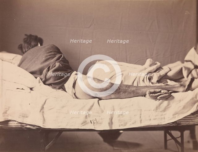Private George Ruoss, Co. G, 7th New York Volunteers, 1865-1866. Creator: Reed Brockway Bontecou.