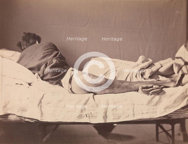 Private George Ruoss, Co. G, 7th New York Volunteers, 1865-1866. Creator: Reed Brockway Bontecou.