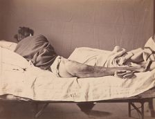 Private George Ruoss, Co. G, 7th New York Volunteers, 1865-1866. Creator: Reed Brockway Bontecou