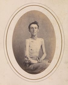 Private James H. Stokes, Company H, 185th New York Volunteers, April-May 1865. Creator: Reed Brockway Bontecou