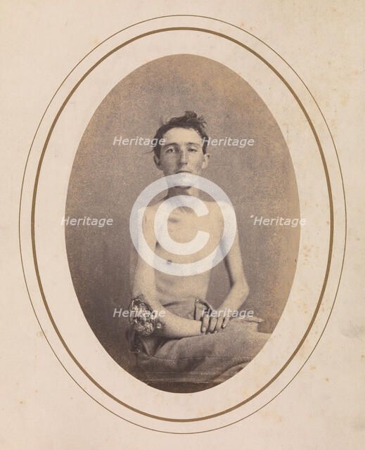 Private James H. Stokes, Company H, 185th New York Volunteers, April-May 1865. Creator: Reed Brockway Bontecou.