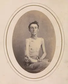 Private James H. Stokes, Company H, 185th New York Volunteers, April-May 1865. Creator: Reed Brockway Bontecou
