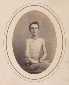 Private James H. Stokes, Company H, 185th New York Volunteers, April-May 1865. Creator: Reed Brockway Bontecou