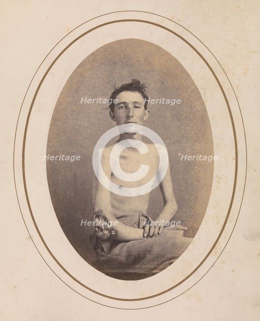 Private James H. Stokes, Company H, 185th New York Volunteers, April-May 1865. Creator: Reed Brockway Bontecou.