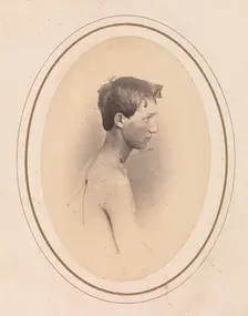 Private Jacob F. Simmons, Company H, Eighty-second Pennsylvania Volunteers, April-May 1865. Creator: Reed Brockway Bontecou