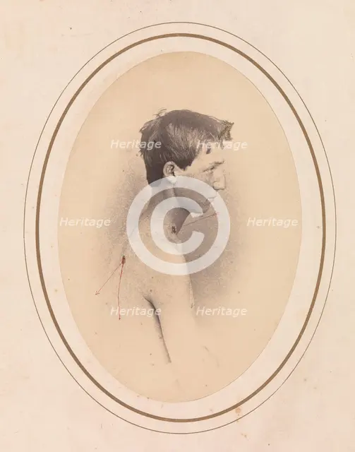 Private Jacob F. Simmons, Company H, Eighty-second Pennsylvania Volunteers, April-May 1865. Creator: Reed Brockway Bontecou.