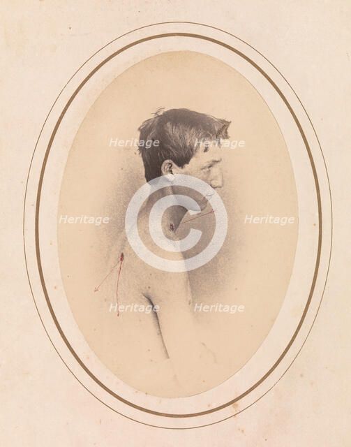 Private Jacob F. Simmons, Company H, Eighty-second Pennsylvania Volunteers, April-May 1865. Creator: Reed Brockway Bontecou.