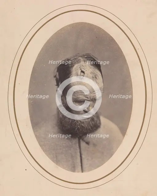 Private John Parkhurst, Company E, Second New York Heavy Artillery, 1865. Creator: Reed Brockway Bontecou.