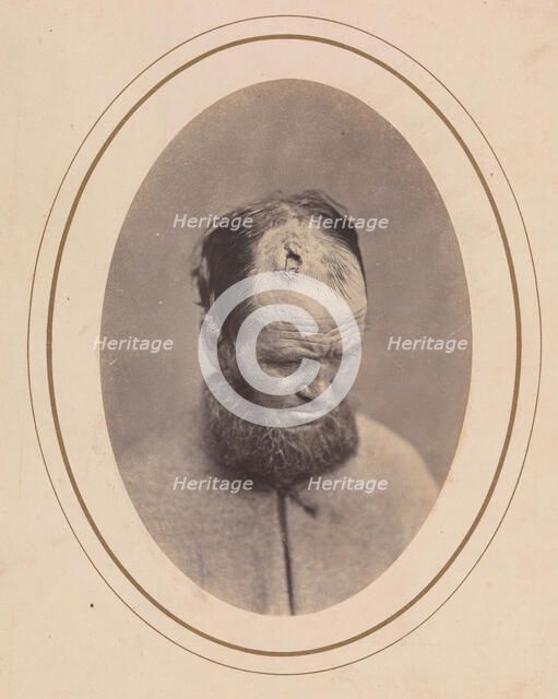 Private John Parkhurst, Company E, Second New York Heavy Artillery, 1865. Creator: Reed Brockway Bontecou.