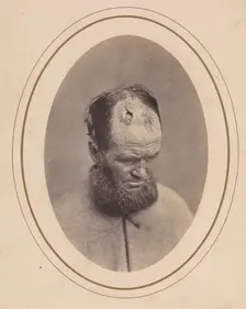 Private John Parkhurst, Company E, Second New York Heavy Artillery, 1865. Creator: Reed Brockway Bontecou