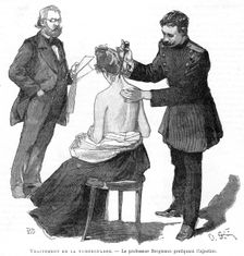Professor Bergmann injecting a tuberculosis patient, 1891. Creator: Unknown