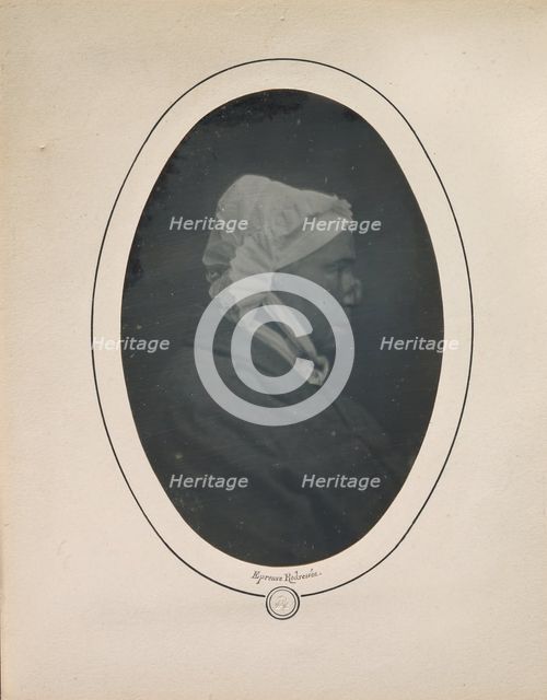 [Profile of a Woman with Necrosis of the Nose], 1841-48. Creator: Louis-Auguste Bisson.