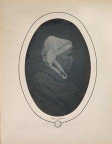 [Profile of a Woman with Necrosis of the Nose], 1841-48. Creator: Louis-Auguste Bisson